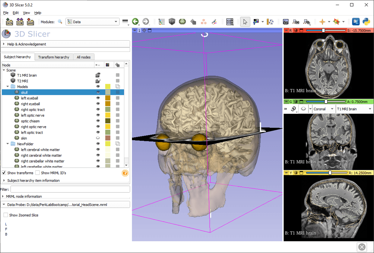 Medical Systems 3D Data Loading & Visualization Graphic